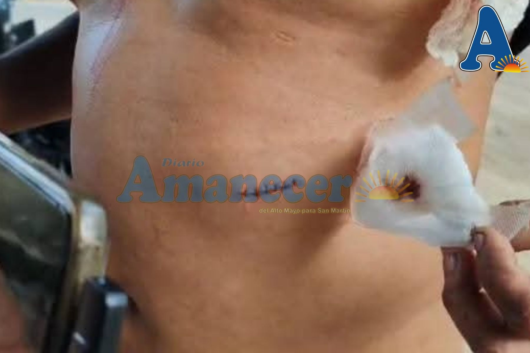 MUJER ATACA A SU PAREJA CON CUCHILLO