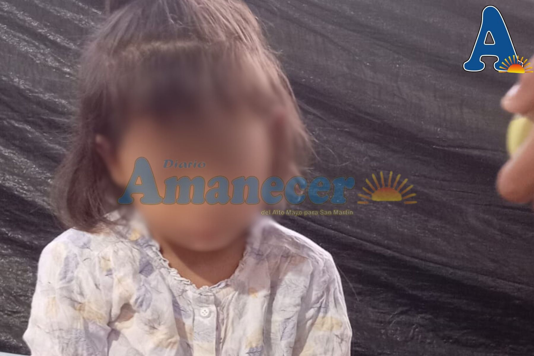 NIÑA DE 06 SUFRE GRAVE ACCIDENTE