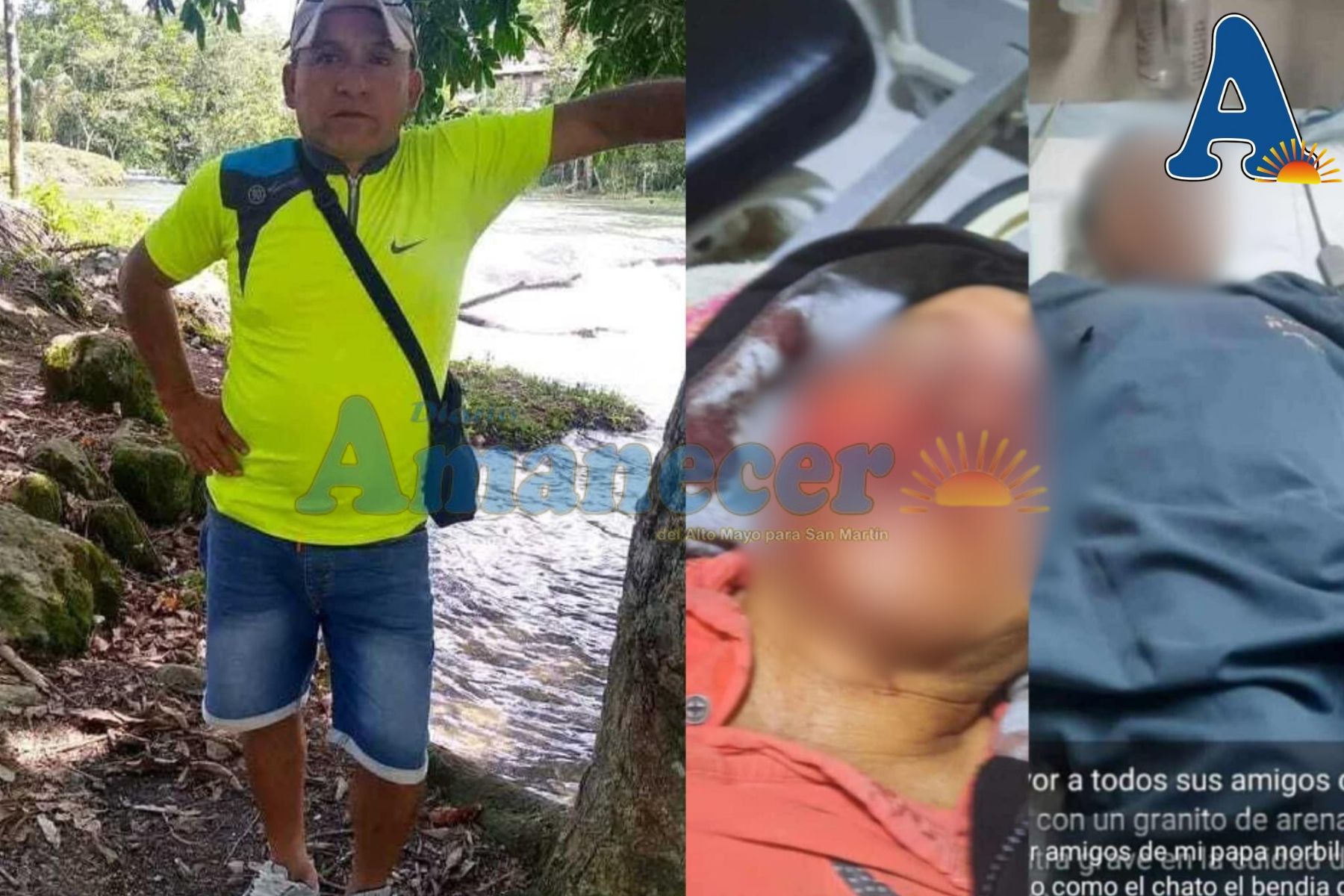 HOMBRE QUE SUFRIÓ ACCIDENTE PIDE APOYO